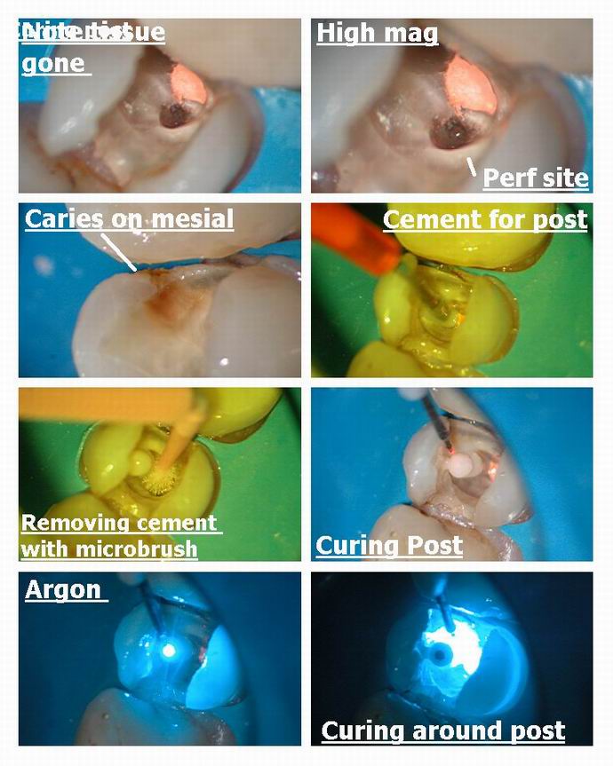 Resize of Premolar pg 2.jpg